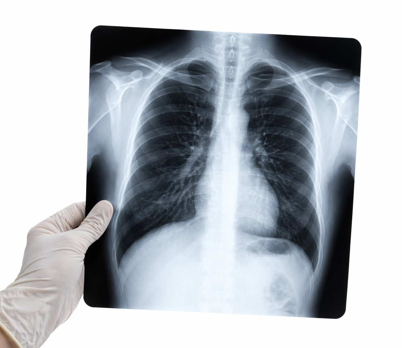 Radiología con enfoque clínico en Devalogy